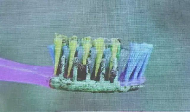 Ağız Hijyeni Kalp Ameliyatlarında Hayati Öneme Sahip!