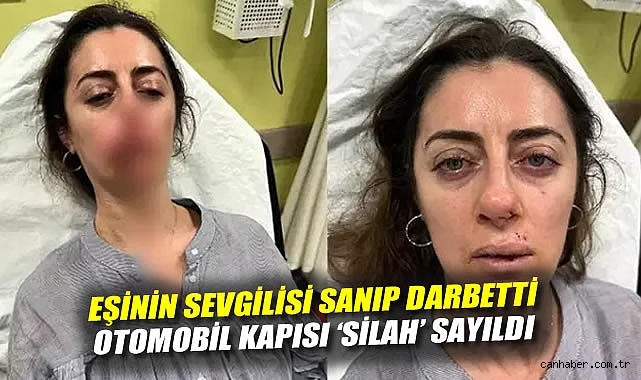 Yanlış Anlama, Yaşamı Tehdit Eden Saldırıya Dönüştü!
